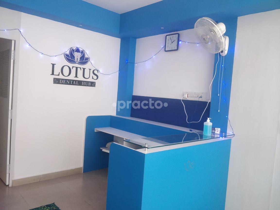 Reception Area at Lotus Dental Hub Kasturi nagar Bangalore