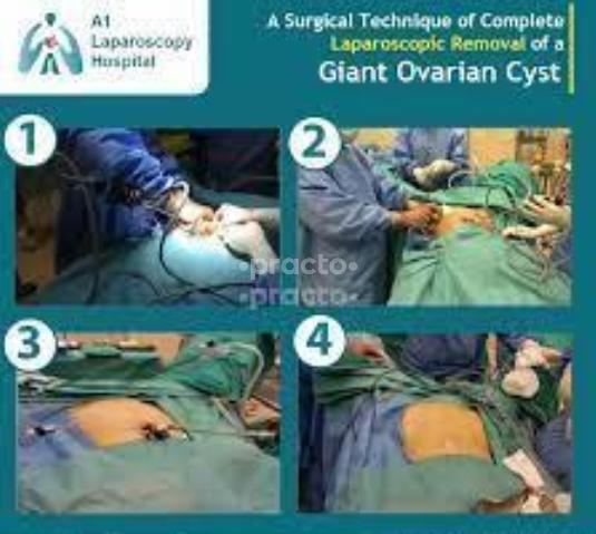 A1 Laparoscopy Hospital Maharani Peta Visakhapatnam
