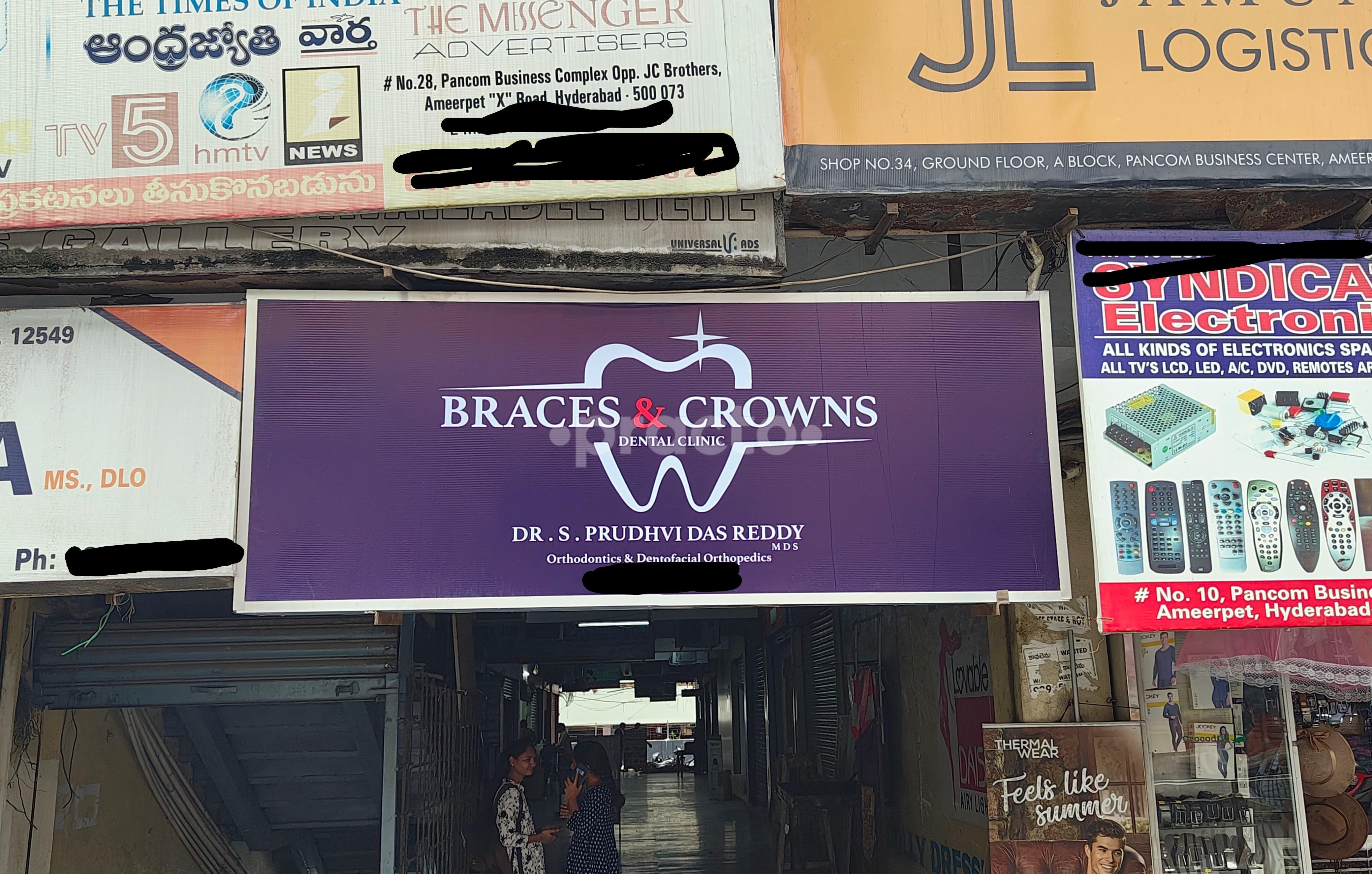 Braces and Crowns Ameerpet Hyderabad