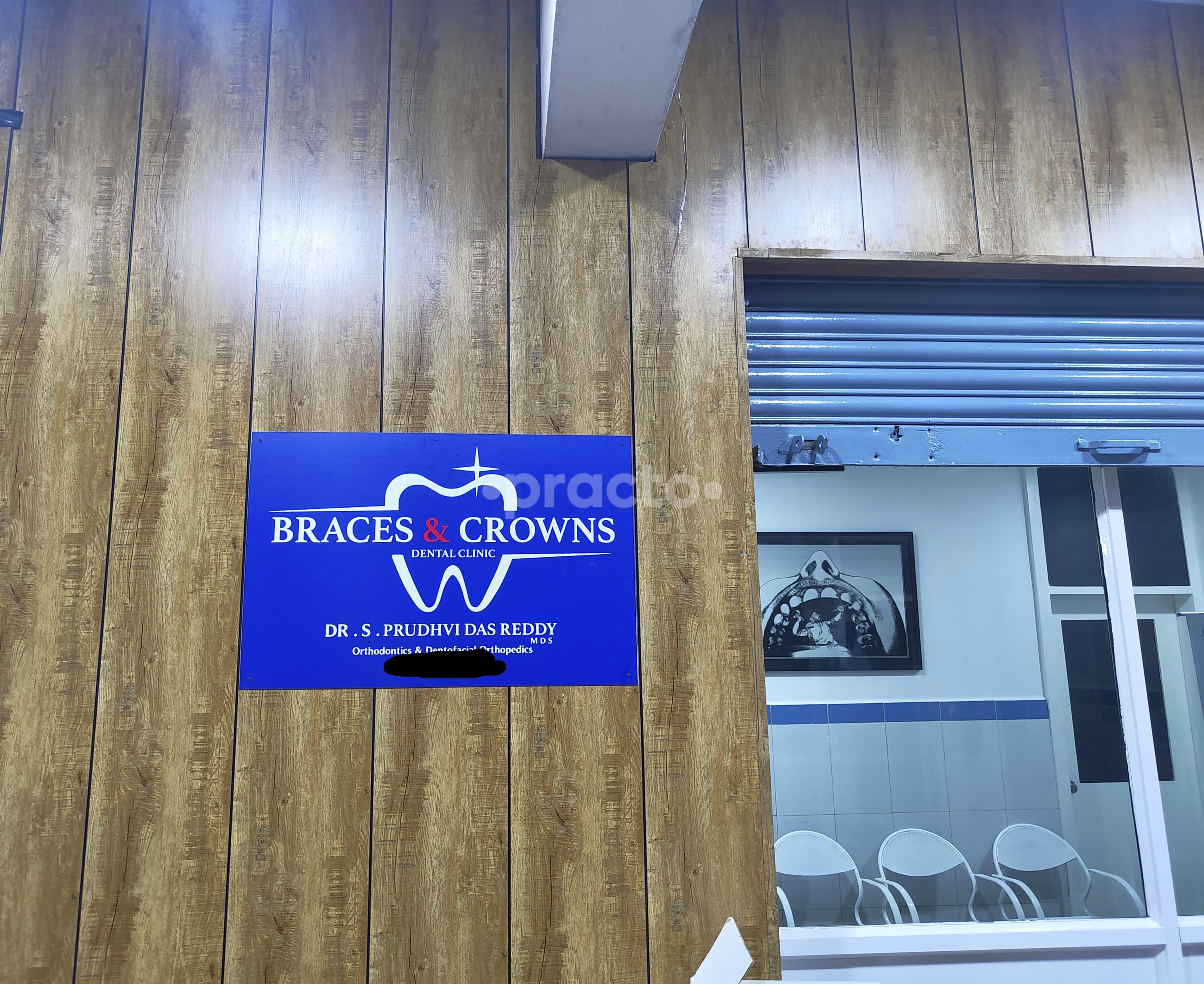 Braces and Crowns Ameerpet Hyderabad
