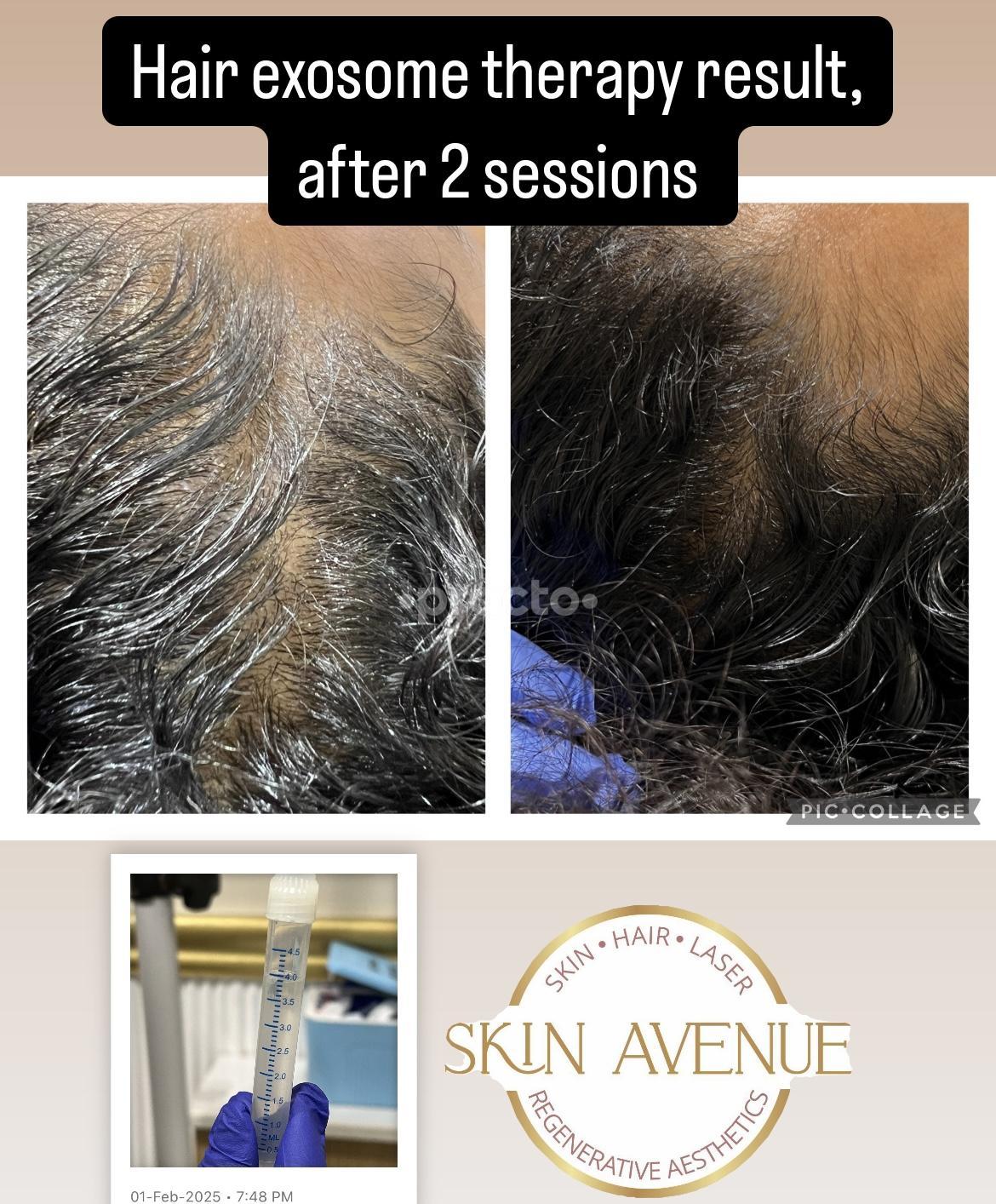 Other at Skin Avenue Clinic Gurgaon Sector 43 Gurgaon