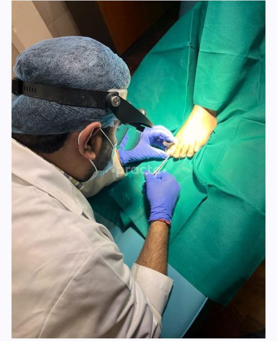 Operation Room at Skinfollics Malviya Nagar Delhi