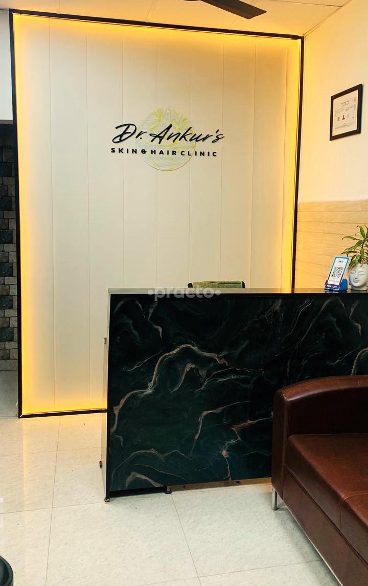 Reception Area at Dr Ankur's Skin and Hair Clinic Rohini Sector 20 Delhi