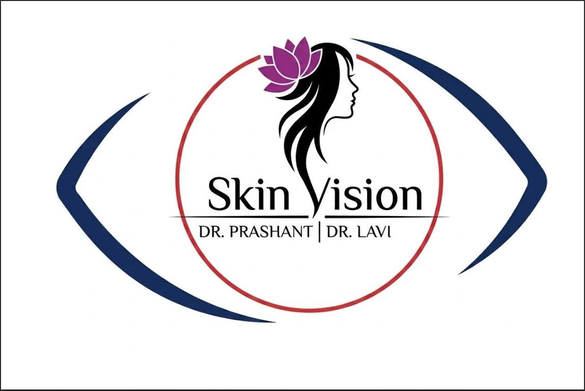 SkinVision