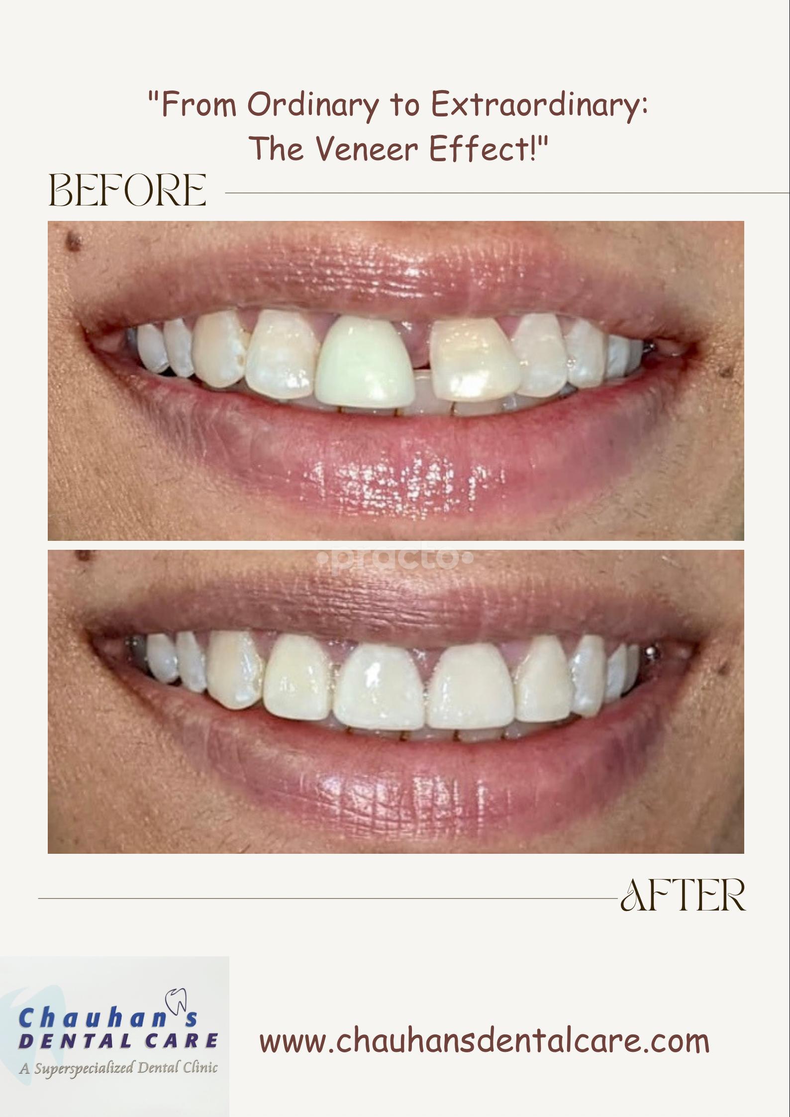 Chauhan's Dental Care Baner Road Pune