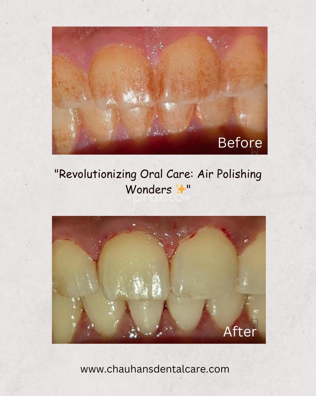 Chauhan's Dental Care Baner Road Pune