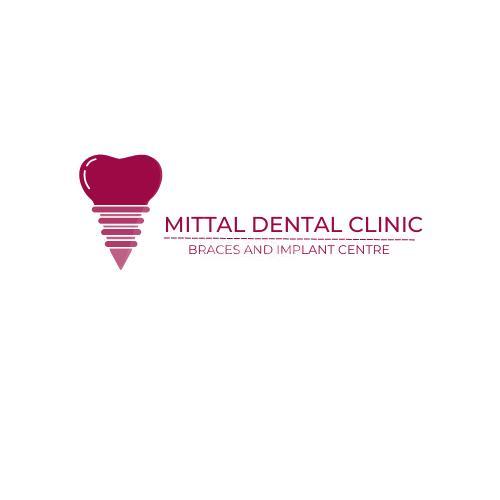 Mittal Dental Clinic & Implant Centre