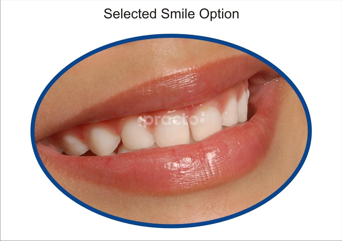 Others at Dr. Praveen's Specialty Dental Hospital KPHB Hyderabad