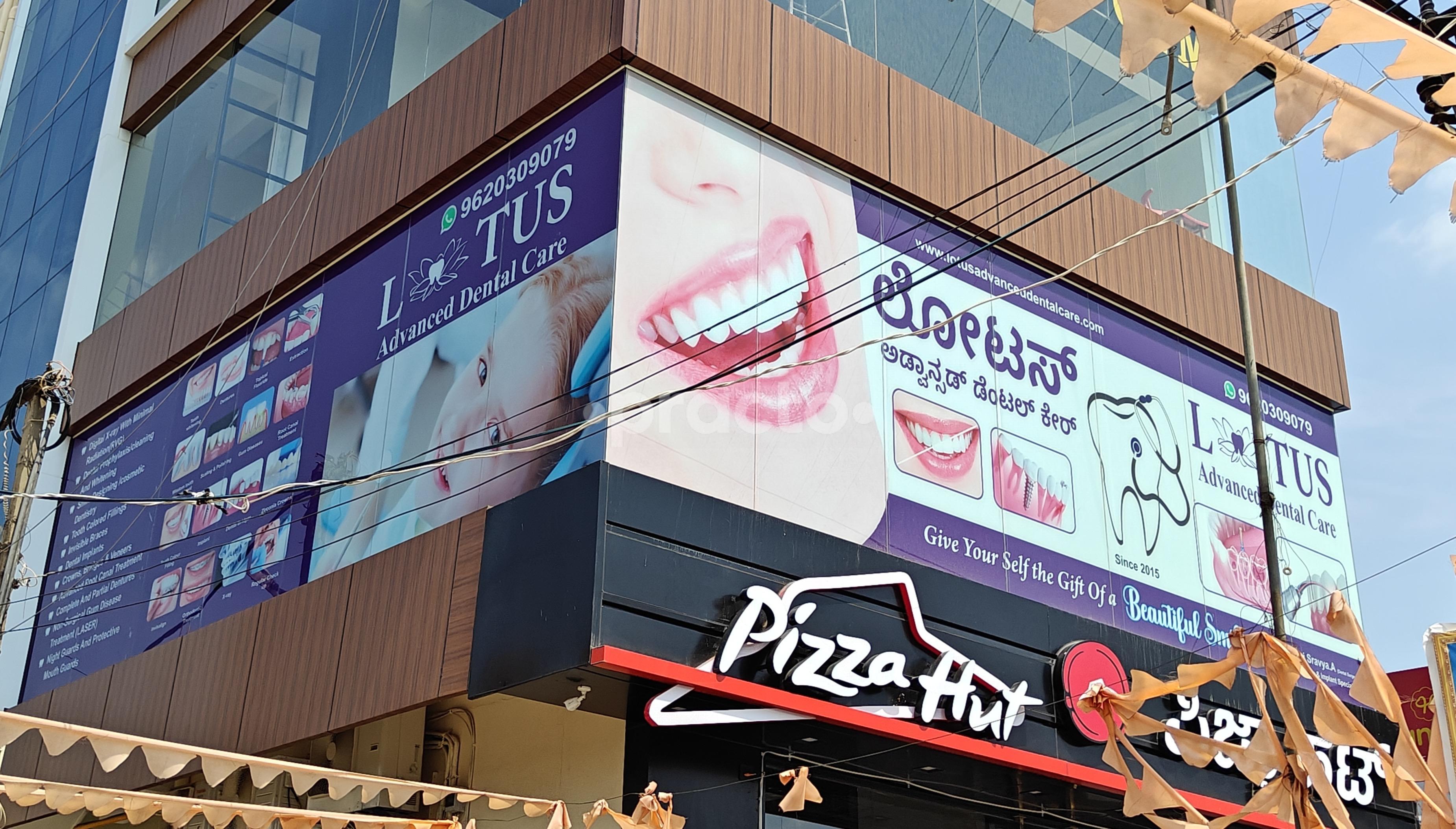 Outside Area at Lotus Advanced Dental Care Thanisandra Main Road Bangalore