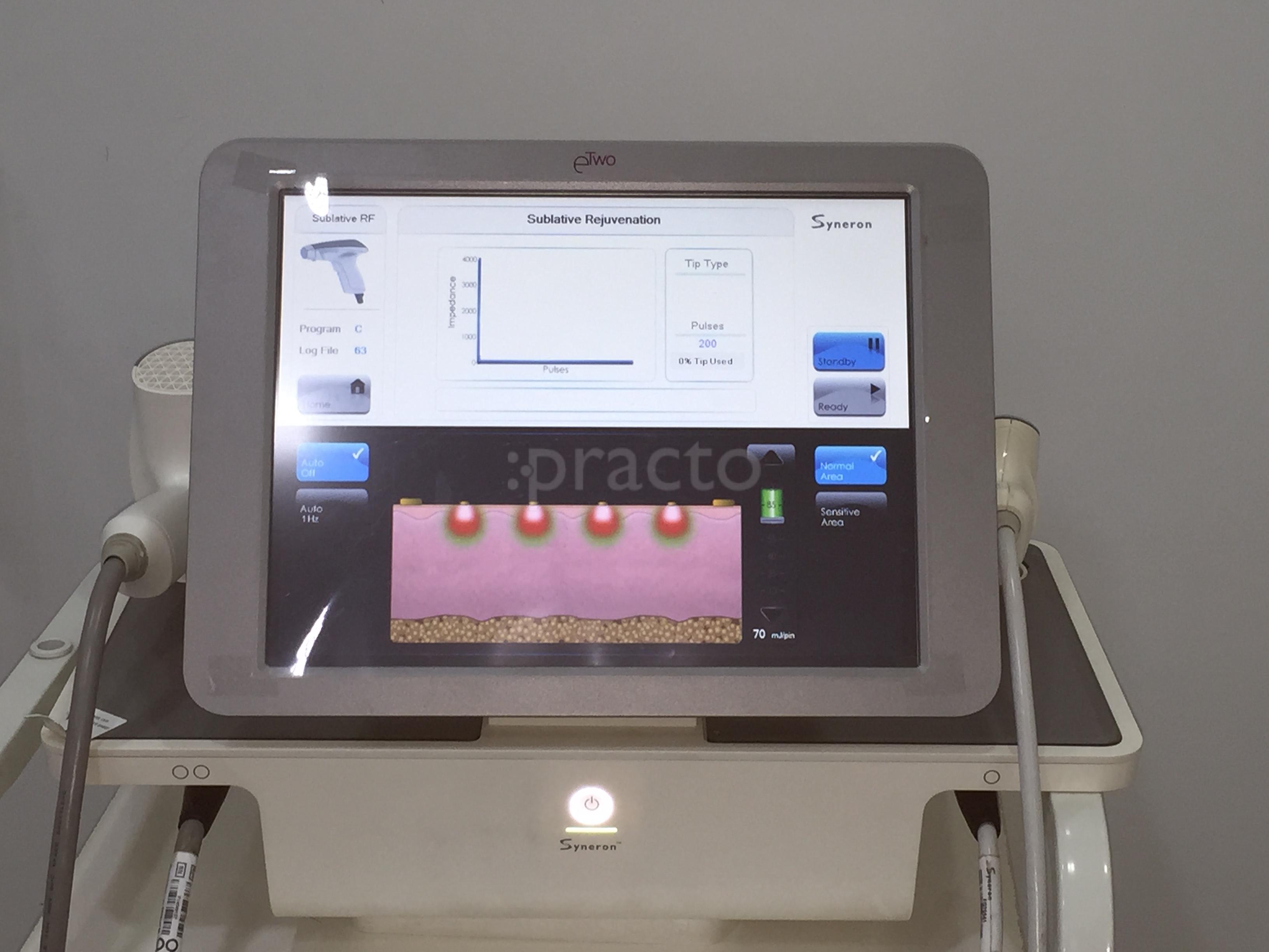 Equipment Area at RD Clinic- Skin, Trichology & Aesthetics Chembur Mumbai