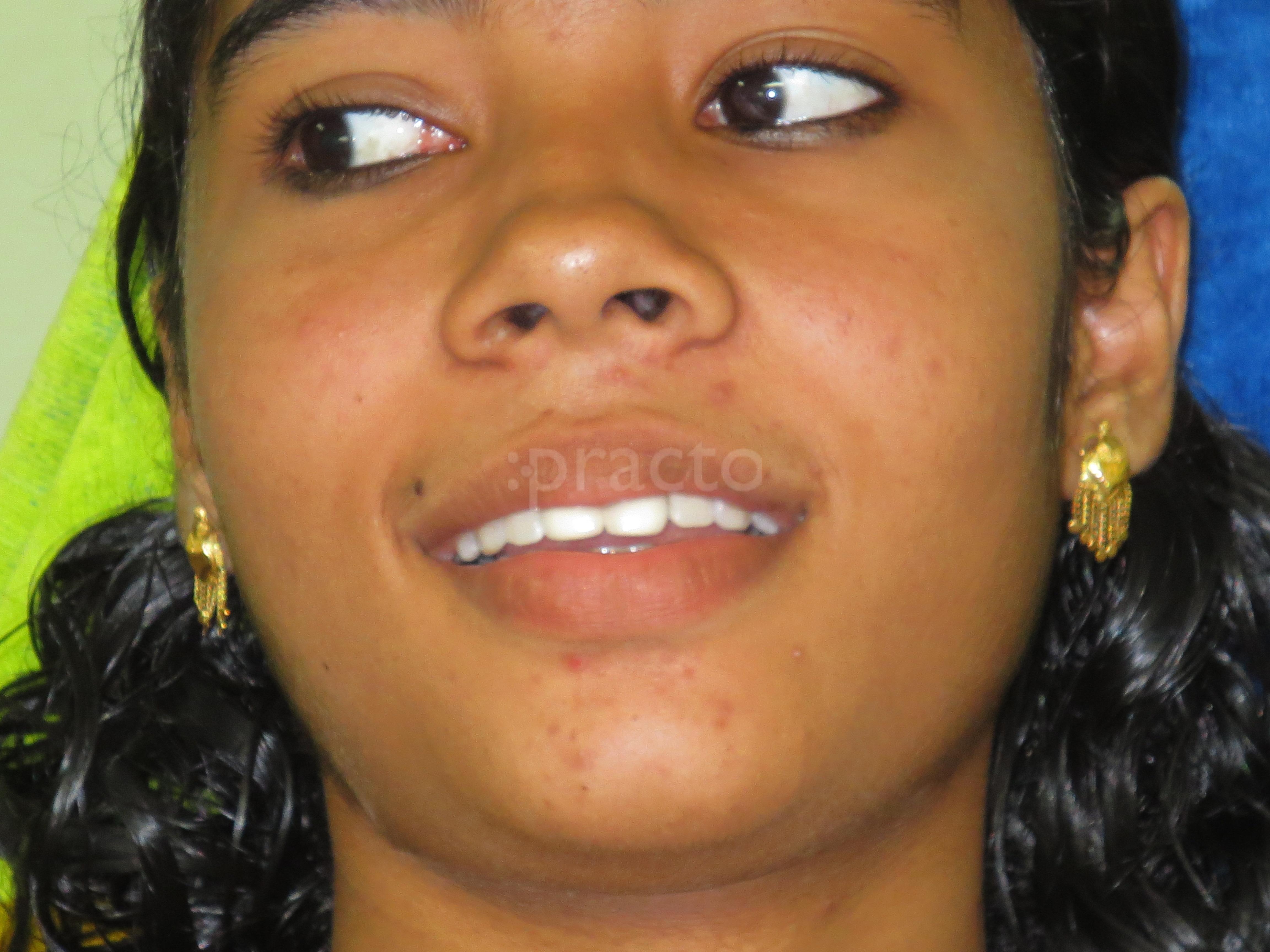 Relief Dental Hospital Pothencode Thiruvananthapuram
