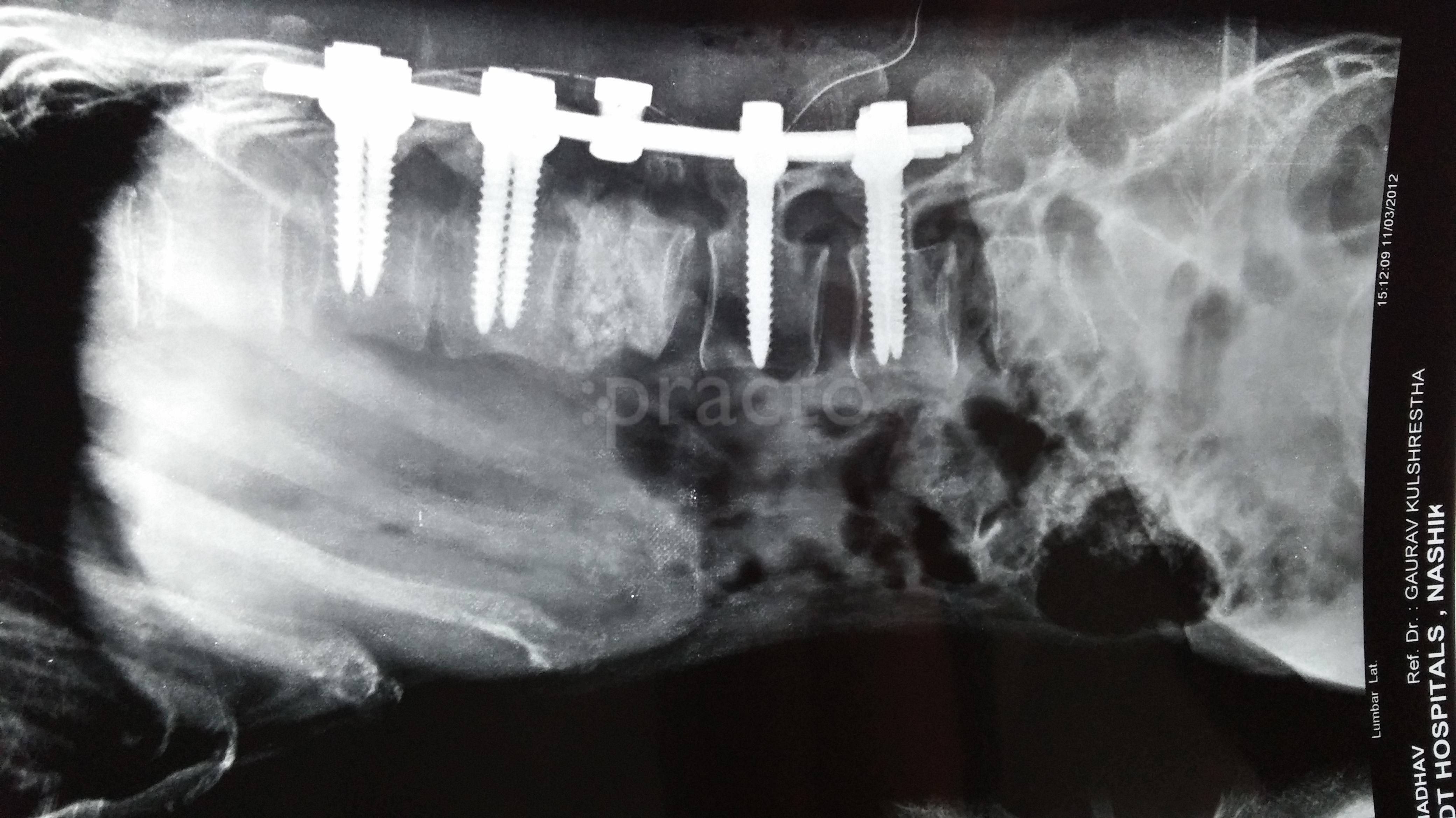 Spine Surgeon - Dr Kulshrestha's Spine Clinic Gaikwad Nagar Nashik