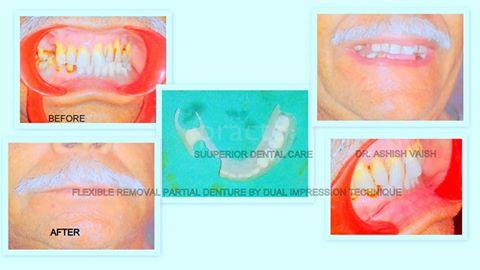 Superior Dental Care Shyam Nagar Kanpur
