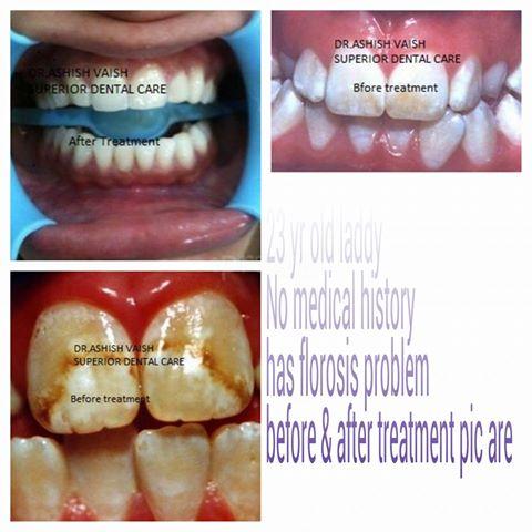 Superior Dental Care Shyam Nagar Kanpur