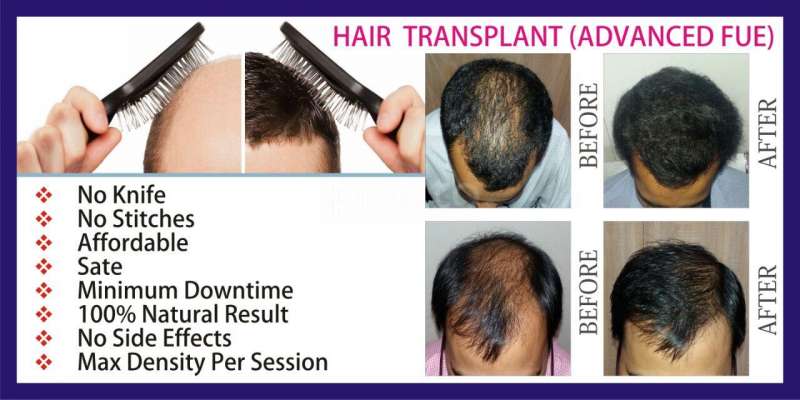 Tricho-Derma Hair & Skin Speciality Clinic, Multi-Speciality Clinic in JP Nagar 2 Phase, Bangalore - Book Appointment, View Fees, Feedbacks | Practo Tricho-Derma Hair & Skin Speciality Clinic, Multi-Speciality Clinic in JP Nagar 2 Phase, Bangalore - Book Appointment, View Fees, Feedbacks | Practo