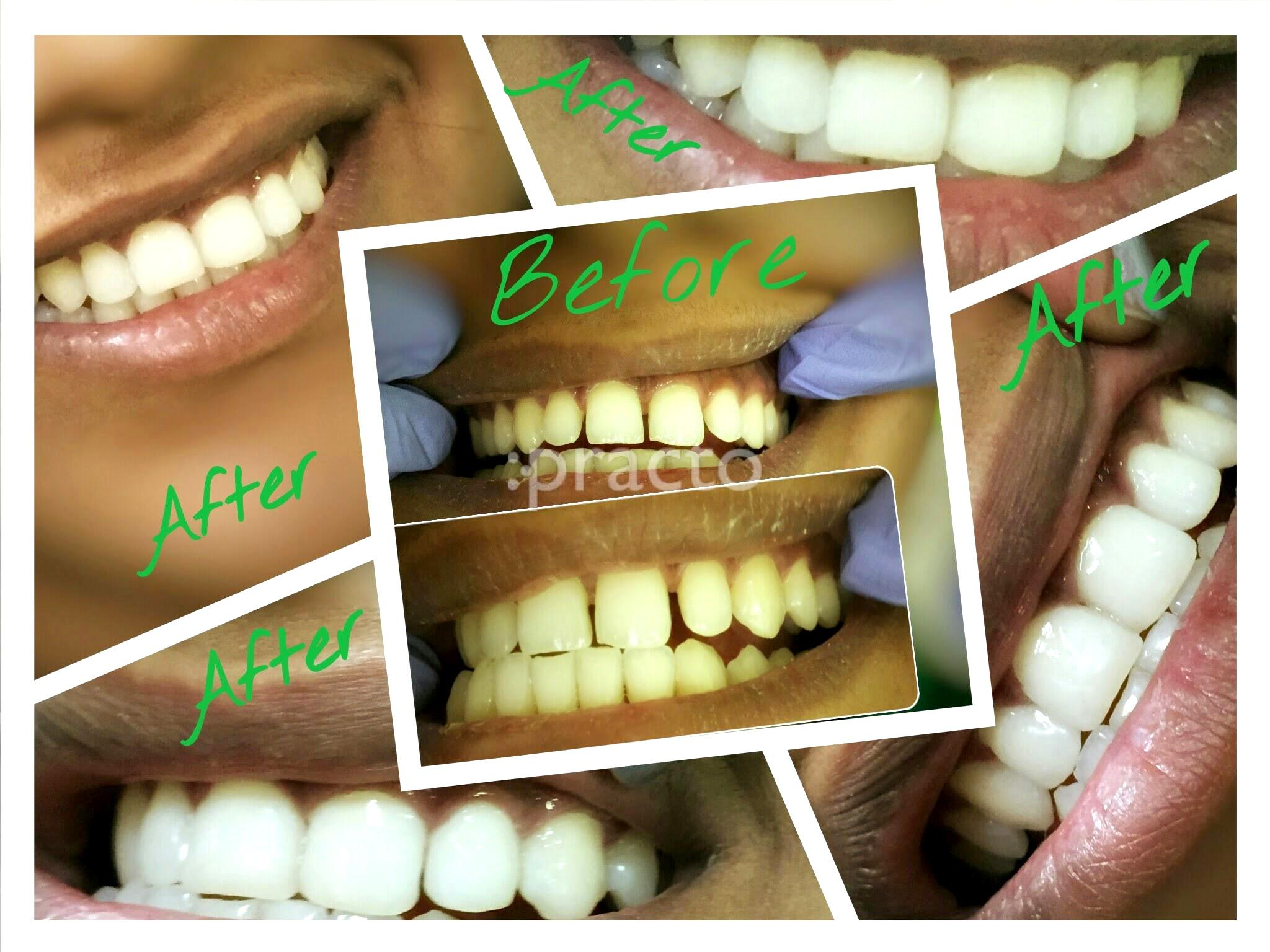 Others at V.R. Smile Makers Dental Care Hadapsar Pune