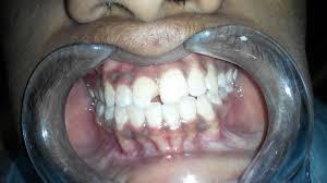 Vijay Dental Clinic Vsi Shivpur Varanasi